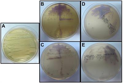 Candida guilliermondii as an agent of postpartum subacute mastitis in Rio de Janeiro, Brazil: Case report